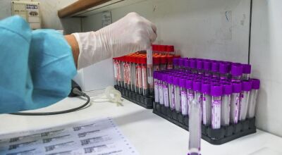 O total de mortes causadas por covid-19 chega a 138.108, um acréscimo de 0,6% sobre a soma de segunda