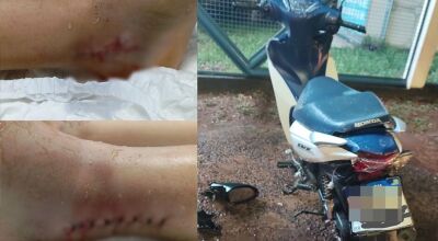Uma das vítimas quase não teve ferimentos enquanto a outra passou por cirurgia nos pés / Reprodução/Reporter Top