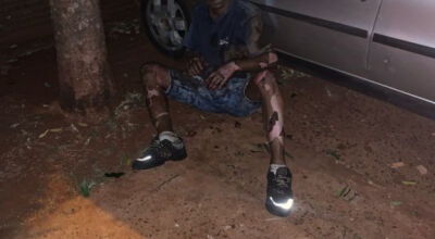 Homem sentado no chão com queimaduras; Foto: Ligado Na Redação