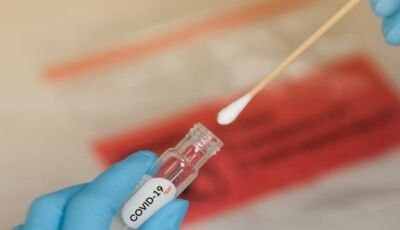 Em uma semana, Mato Grosso do Sul confirma 198 novos casos de Covid-19