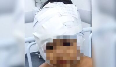 Criança passa por cirurgia após ter rosto dilacerado por Pitbull em MS