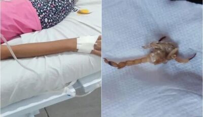 Picada por escorpião em MS: criança de 3 anos está em estado grave em hospital