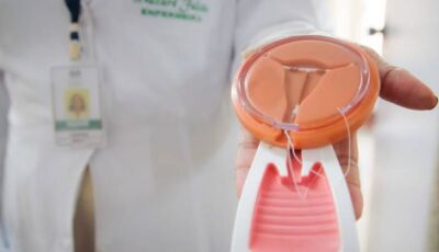 Mais acesso, mais autonomia: Governo fortalece distribuição gratuita de contraceptivos de duração 