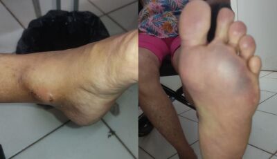 Com pé roxo e sem conseguir andar, idosa sofre sem diagnóstico 