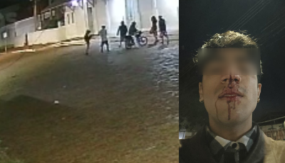 Jovem é espancado por dez homens por beijar rapaz na Esplanada Ferroviária