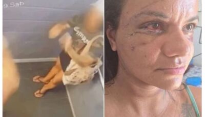 Mulher brutalmente agredida divulga primeira foto após cirurgia de reconstrução facial
Vítima sofreu