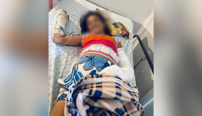 Após 13 dias de agonia, mulher agredida com os dois braços quebrados consegue cirurgia na Santa Casa