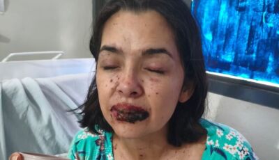 Moradora de Dourados relata luta contra doença rara e alerta para riscos de reações medicamentosas