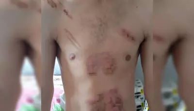 Jovem é torturado, queimado com ferro e chapinha de cabelo por mulher