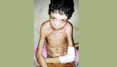 Sonho de menino é "voltar ao normal e estudar" após explosão,