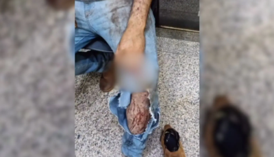 Trabalhador relata ter sido atacado por onça durante colheita