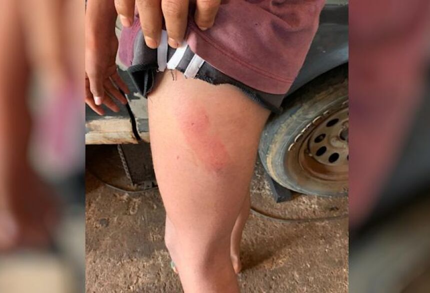 Policia constatou marcas de agressão no corpo do jovem - Foto: Reprodução/TV Anhanguera