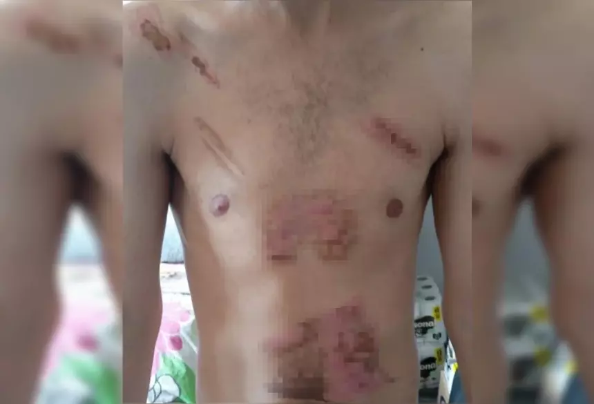 Vítima estaria com os machucados infeccionando / Metrópoles 