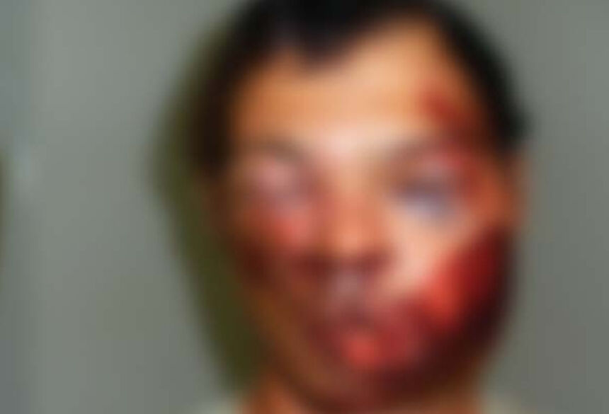 Assaltante ficou machucado após a reação da vítima e reclamava de dores - Foto: Gamarra/Rio Brilhante News