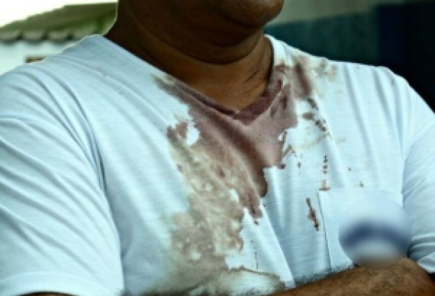 Vítima foi agredida durante assalto em Campo Grande (Foto: Luan Saraiva / G1 MS)