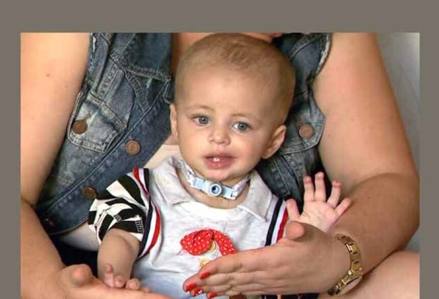 Miguel, de 1 ano, teve extremidades dos dedos e pé esquerdo amputado após ser atendido na Santa Casa de Franca, SP (Foto: Reprodução/EPTV)