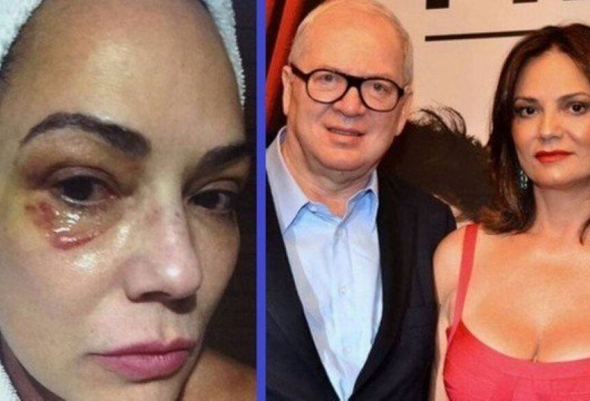 À esquerda, Luiza Brunet após as agressões; à direita, a ex-modelo com Lírio Parisotto Foto: Reprodução/Fantástico/Divulgação