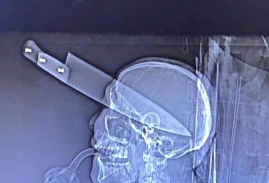 A facada "dividiu ao meio" o cérebro da vítima, que perdeu muita massa encefálica (Foto: Diretos das Ruas)