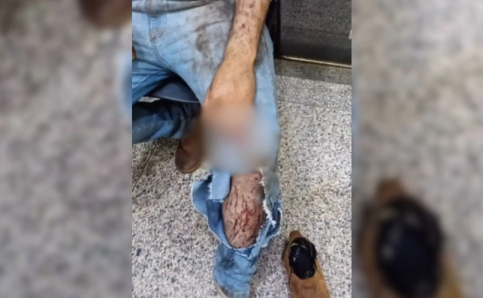 Trabalhador relata ter sido atacado por onça durante colheita