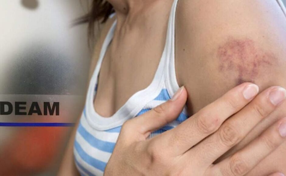 Homem surta e agride companheira após mulher descobrir traições no MS